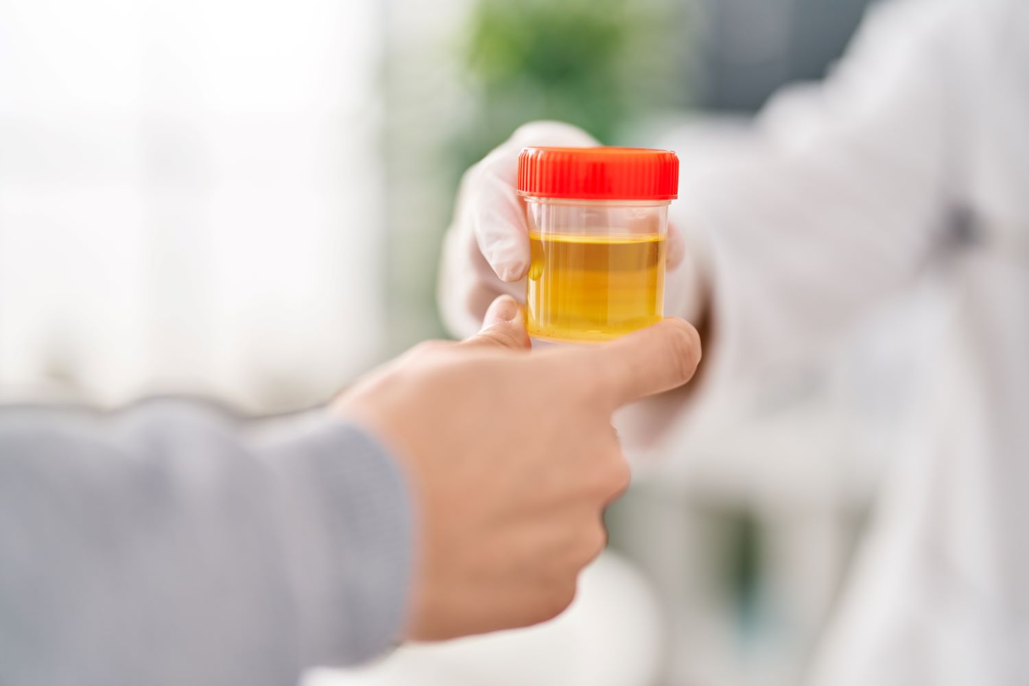 Urine & stool tests