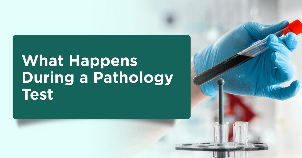 What Happens During a Pathology Test? A Simple Guide for Patients